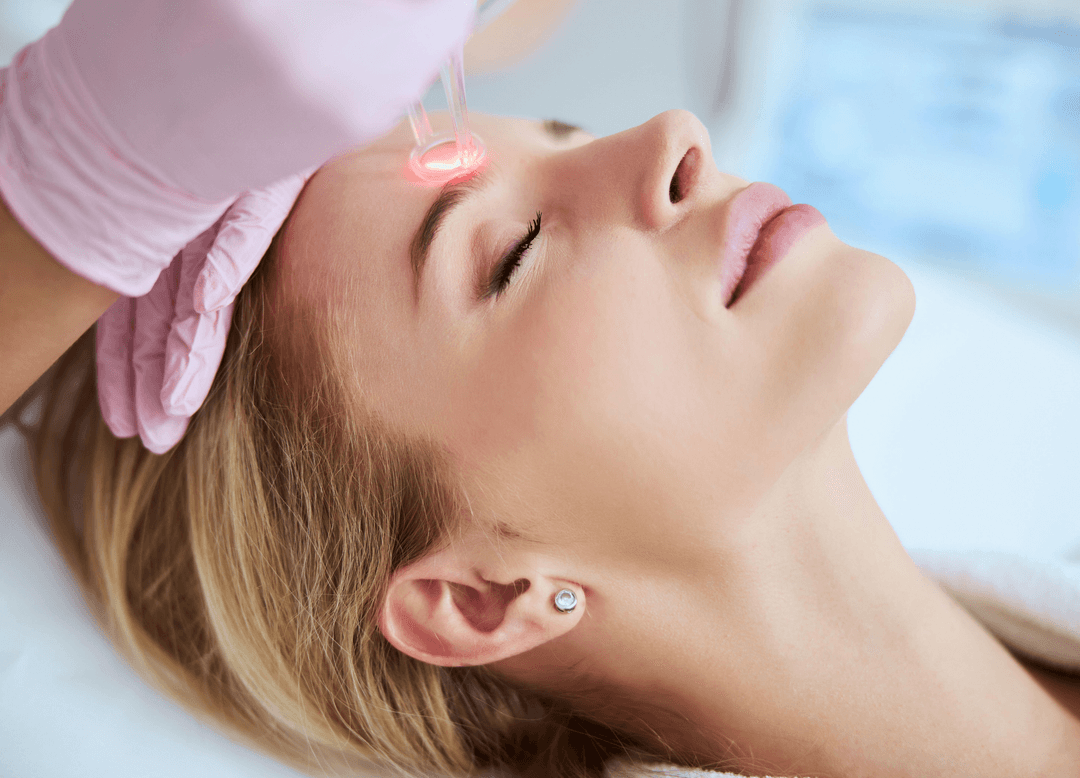 Laser Skin Resurfacing